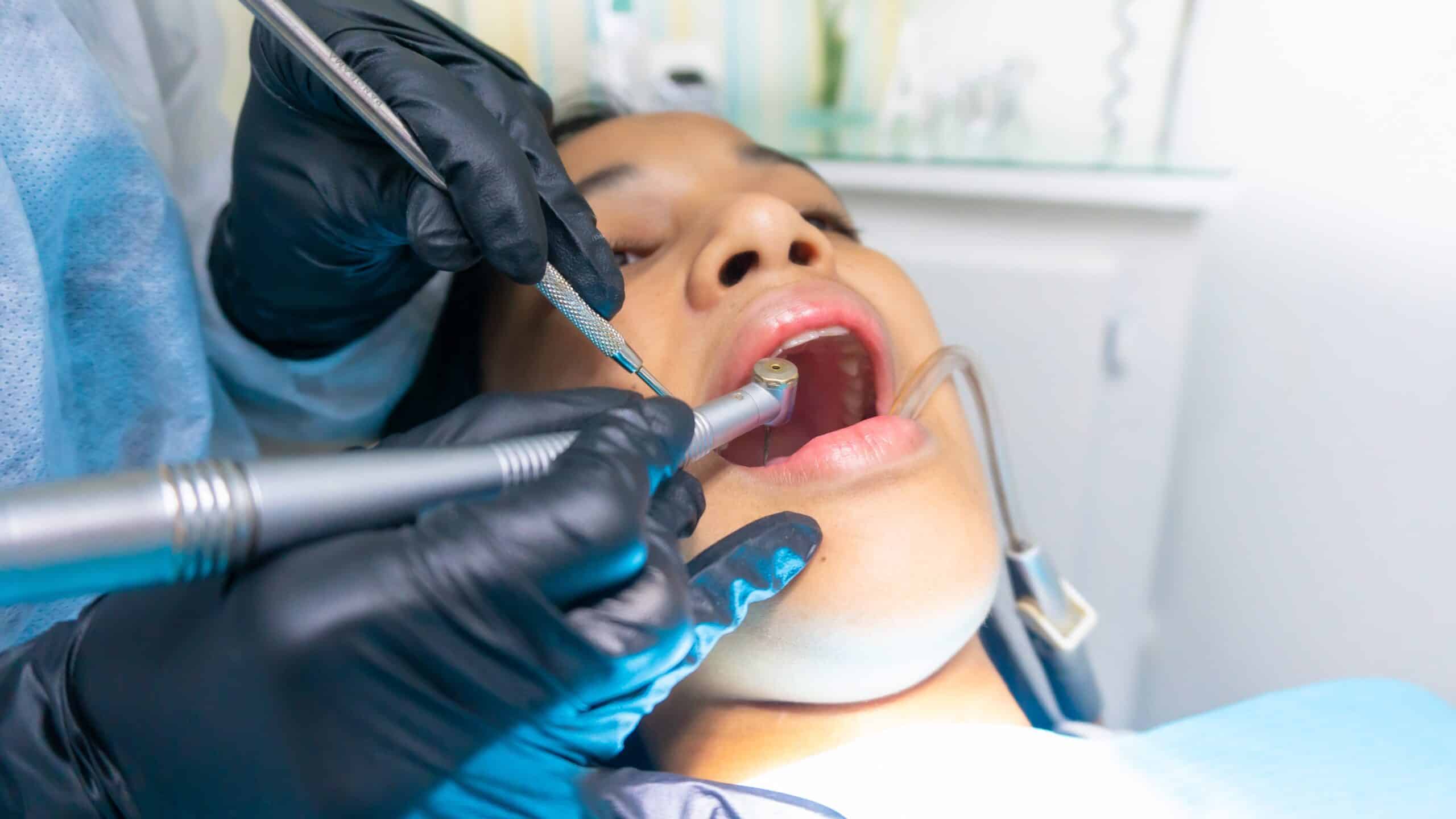 extraction_tooth